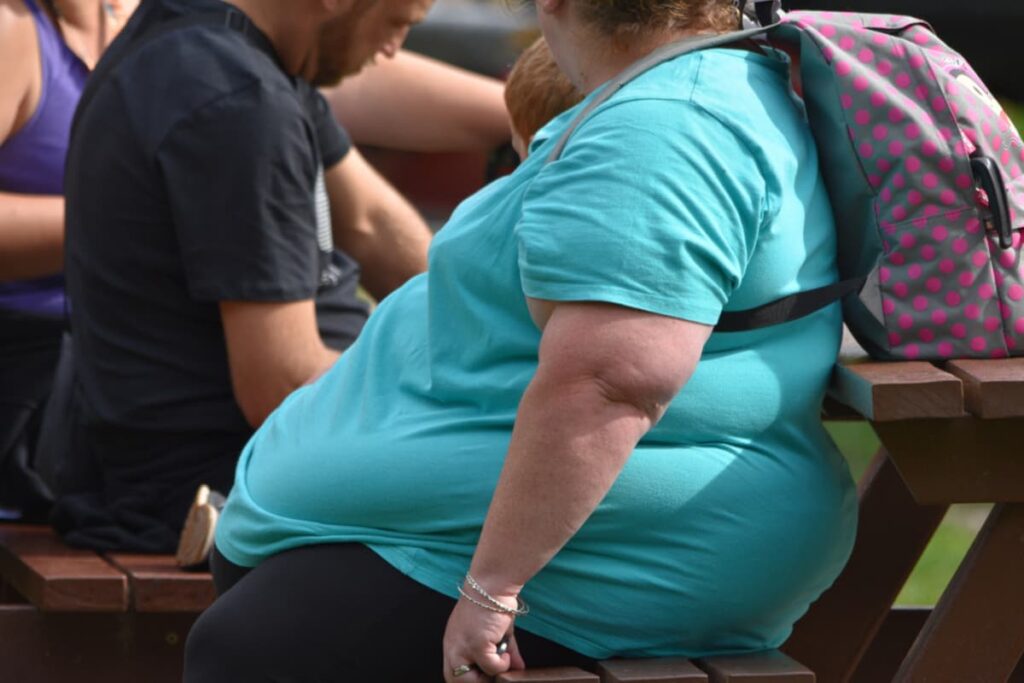 Obésités morbide : comment devenir obèse ?